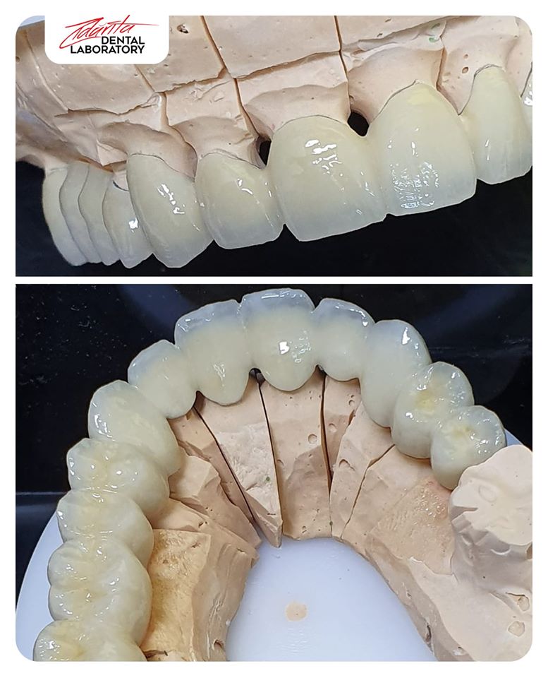 Ceramica3 Ceramică Dentară