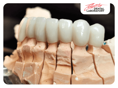 metalo-ceramică Metalo-ceramica