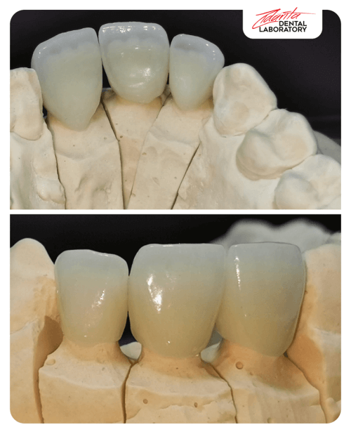 metaloceramic in colaborare cu dr simona metaloceramic in colaborare cu dr simona