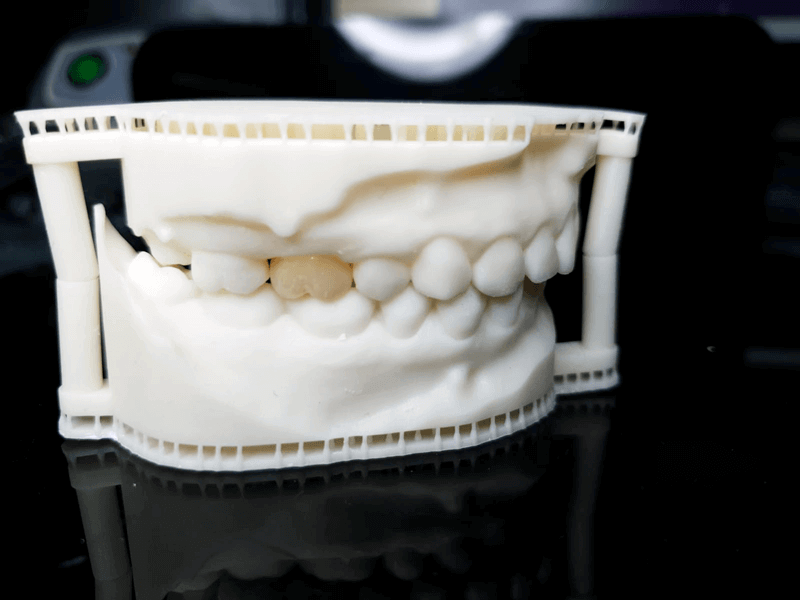 Coroana full zirconiu Amann g