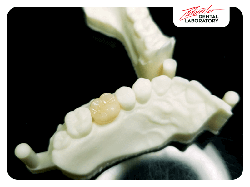 Coroana full zirconiu amann g