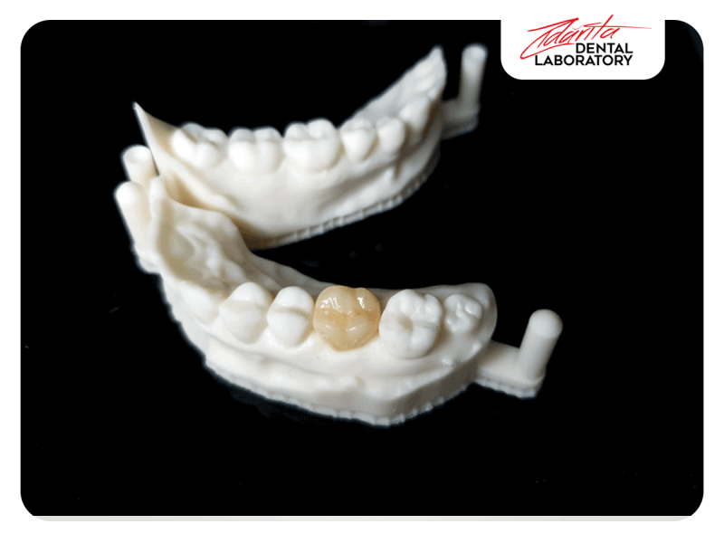 Coroana full zirconiu amann g