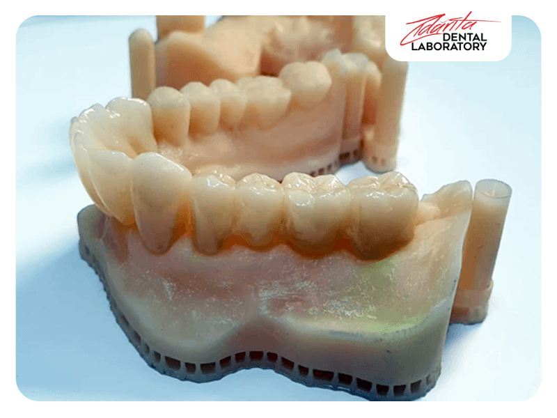 Lucare inferioara full zirconiu Amann G si modele printate 3D
