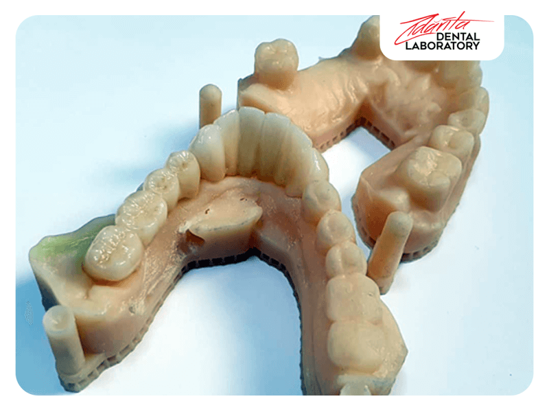 Lucare inferioara full zirconiu Amann G si modele printate 3D