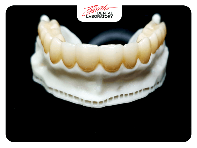 Punte totala de zirconiu amann g si modele printate 3d, lucrare realizata in colaborare cu dr. Ovidiu Tudor