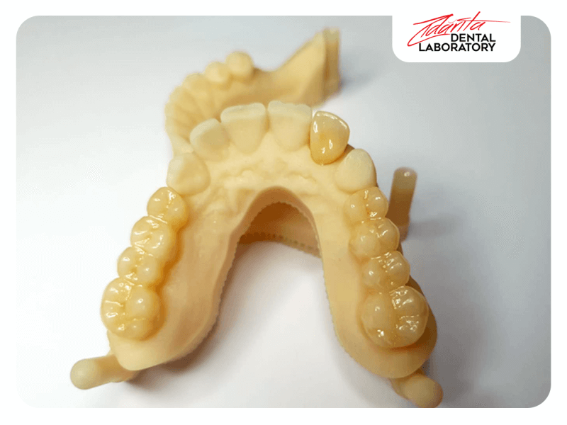 Lucrare integral zirconiu amann g, cu ajutorul amprentei digitale, modele printate 3d cu ajutorul masinii de printat